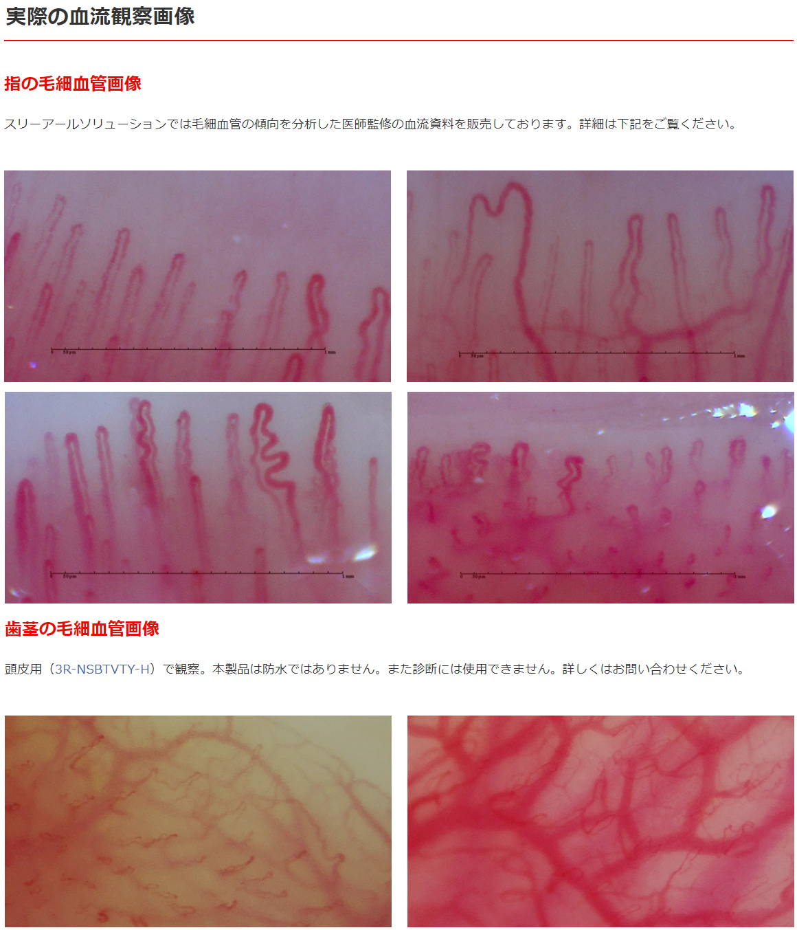 ボタニカルキャンドル バラ かすみ草 Bscan-Pro 毛細血管 血流 観察